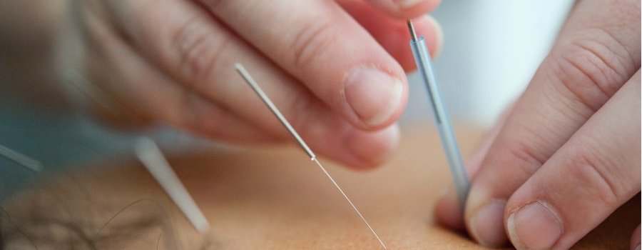 L'acupuncture est-elle efficace ?